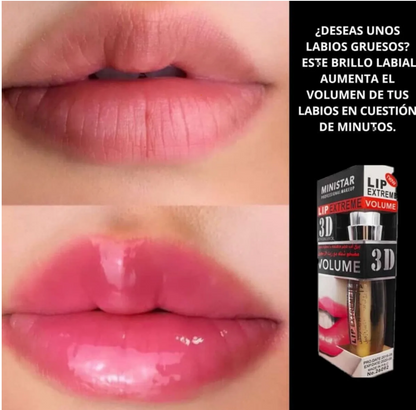 Labial 3D